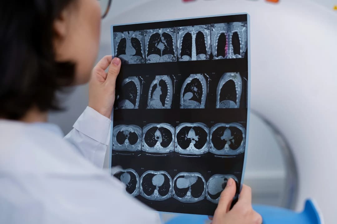 CT Scan