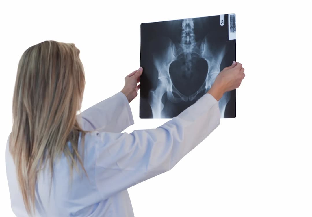 X-Ray