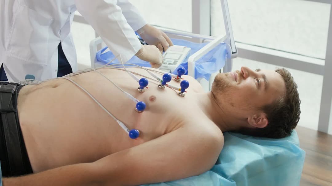 ECG